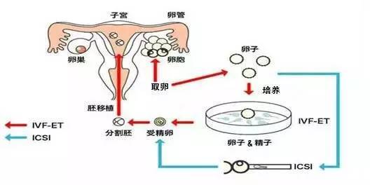 苏州试管婴儿费用